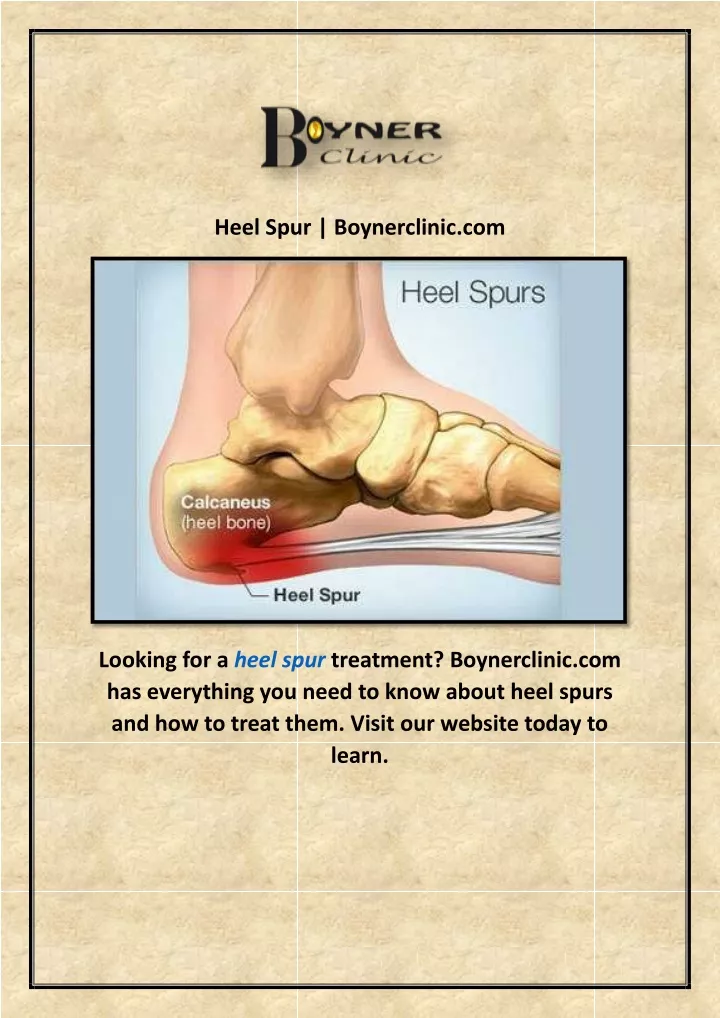 heel spur boynerclinic com