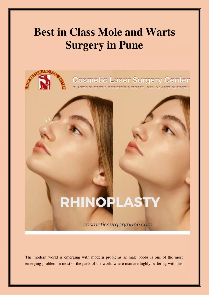 best in class mole and warts surgery in pune