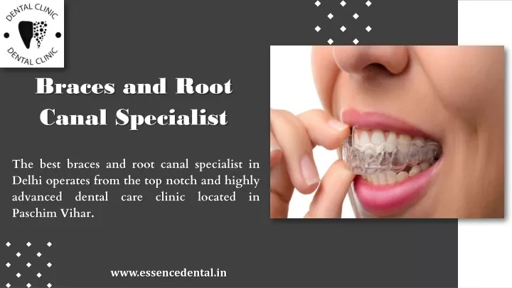 braces and root canal specialist
