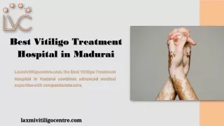 Best Vitiligo Treatment Hospital in Madurai