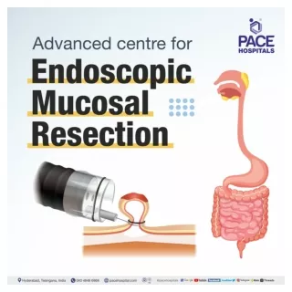 Advanced centre for Endoscopic mucosal resection