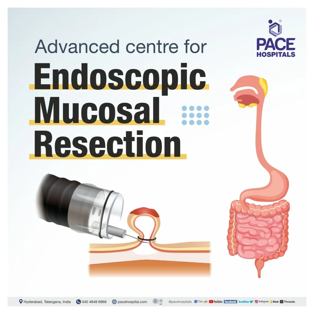 PPT - Advanced centre for Endoscopic mucosal resection PowerPoint ...