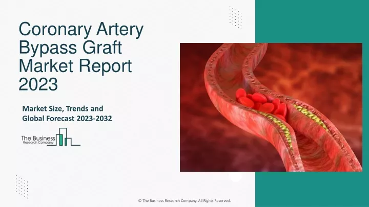 coronary artery bypass graft market report 2023