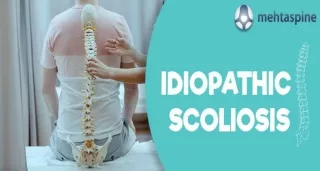 Understanding Idiopathic Scoliosis: Causes, Symptoms, and Treatment | Mehta Spin