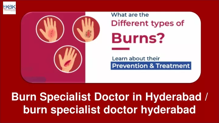 burn specialist doctor in hyderabad burn