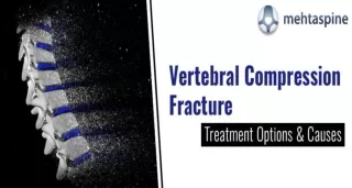 Vertebral Compression Fracture: Treatment Options & Causes | Mehta Spine