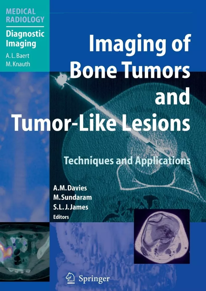 read ebook pdf imaging of bone tumors and tumor