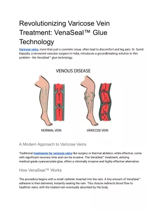 Revolutionizing Varicose Vein Treatment VenaSeal™ Glue Technology