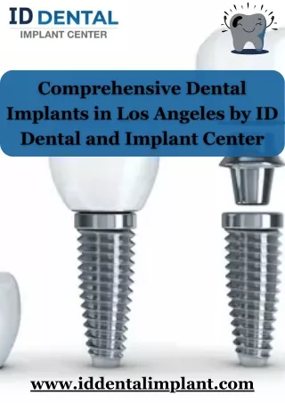 Comprehensive Dental Implants in Los Angeles by ID Dental and Implant Center