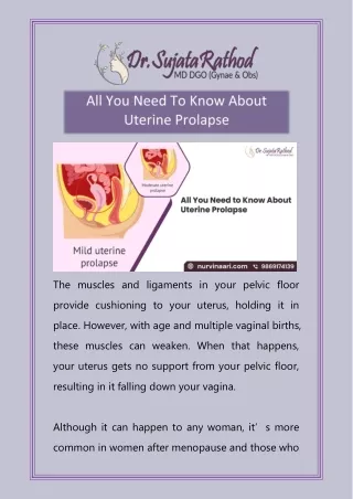 All You Need To Know About Uterine Prolapse
