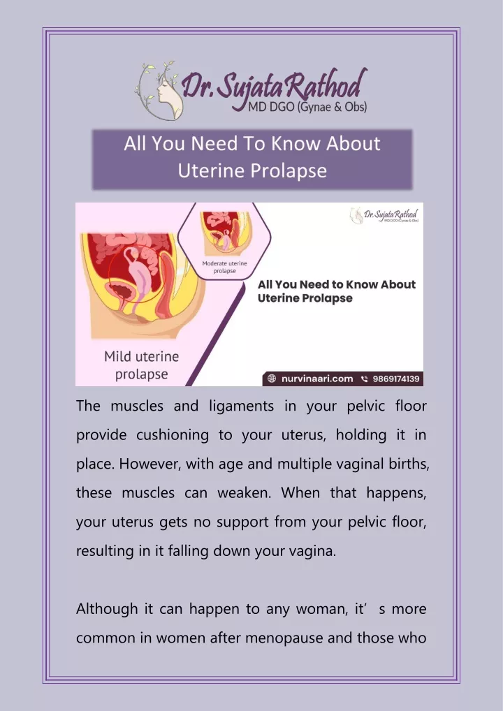 the muscles and ligaments in your pelvic floor