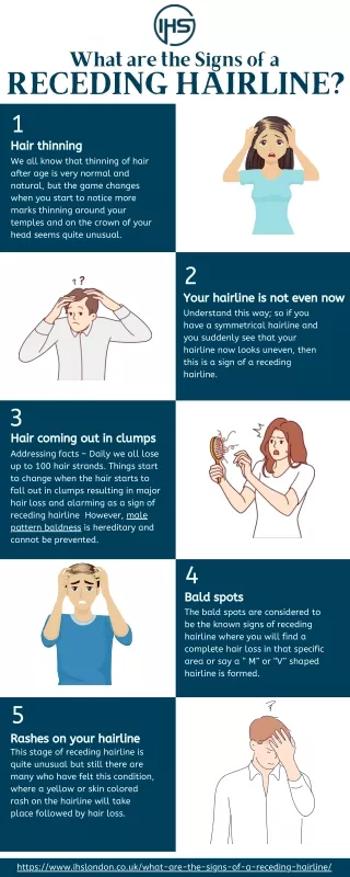 What are the Signs of a Receding Hairline
