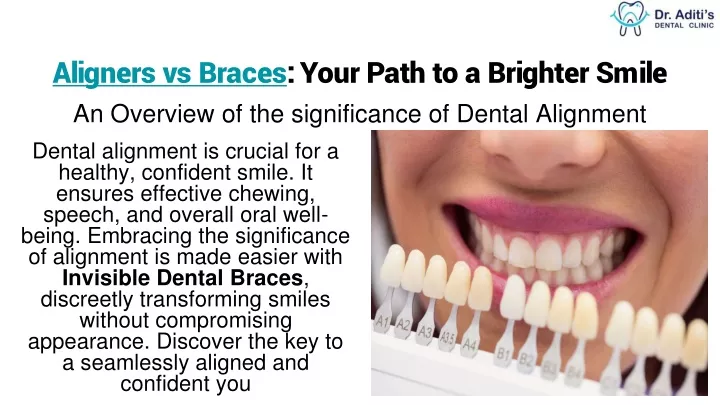 PPT - Aligners vs Invisible Dental Braces: Clear and Convenient