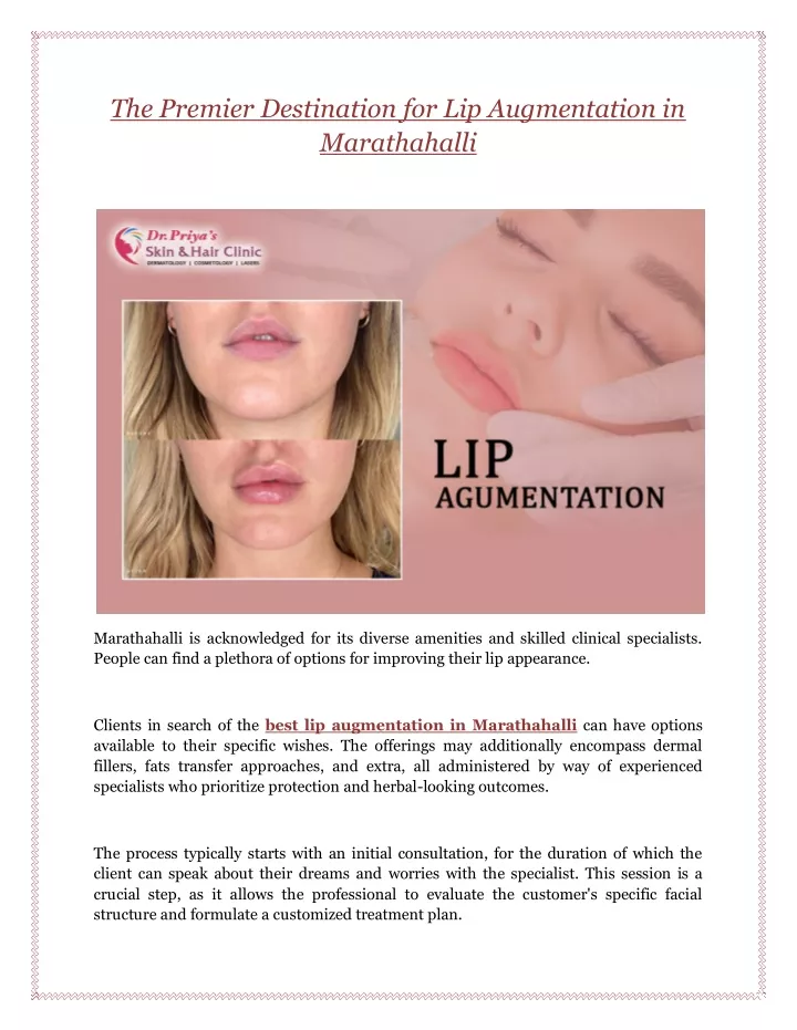 the premier destination for lip augmentation