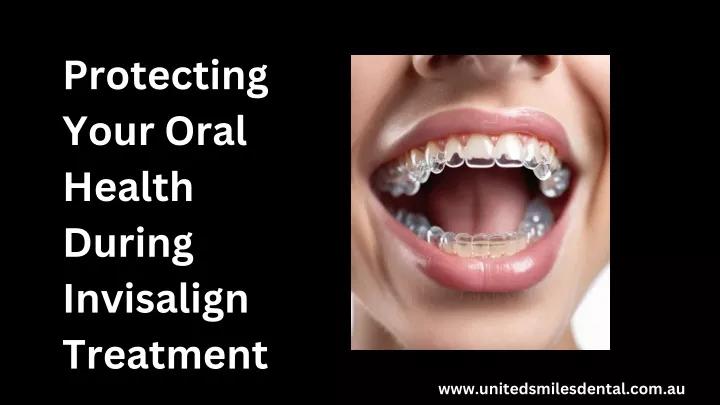 protecting your oral health during invisalign