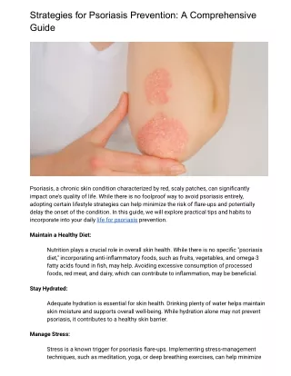 How to avoid psoriasis_
