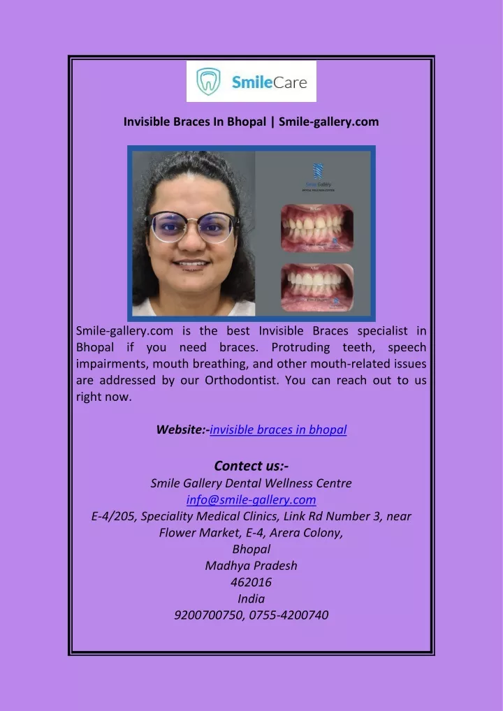 invisible braces in bhopal smile gallery com