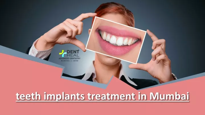 teeth implants treatment in mumbai