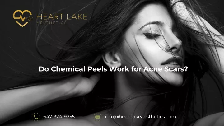 do chemical peels work for acne scars