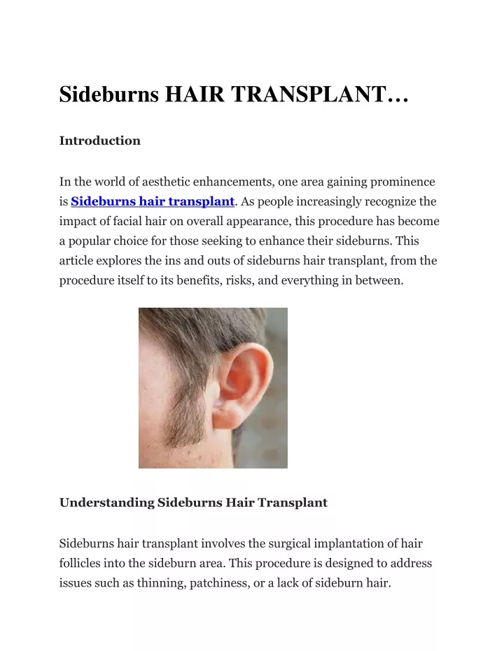 sideburns hair transplant