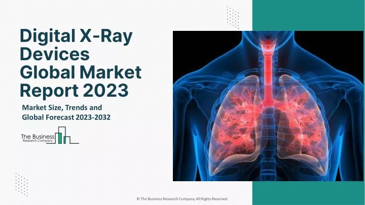 digital x ray devices global market report 2023