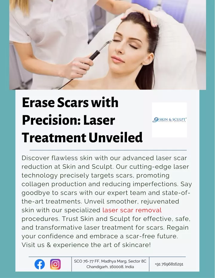 erase scars with precision laser treatment