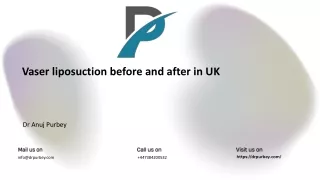 Vaser liposuction before and after in UK  Dr Anuj Purbey