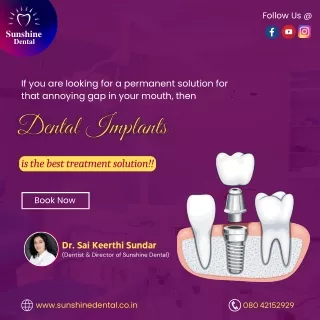 Dental Implants Solution For Gapped Teeth | Sunshine Dental Clinic in Whitefield