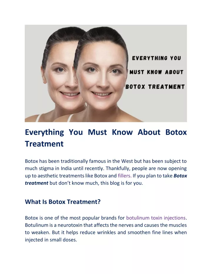 everything you must know about botox treatment