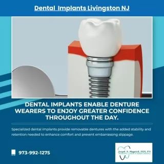 dental implants livingston nj