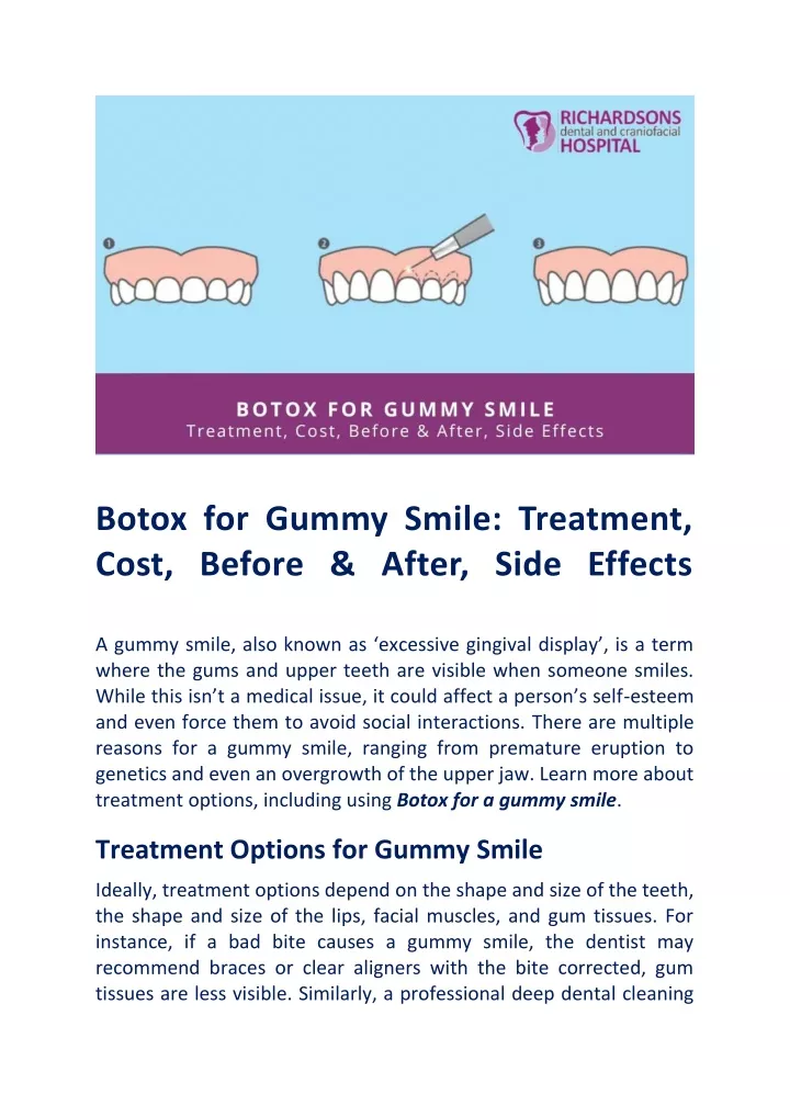 botox for gummy smile treatment cost before after