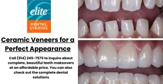 Ceramic Veneers for a Perfect Appearance