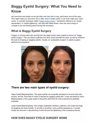 BAGGY EYELID SURGERY