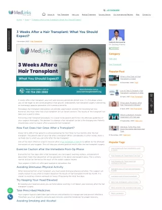 3 Weeks After a Hair Transplant: What You Should Expect?