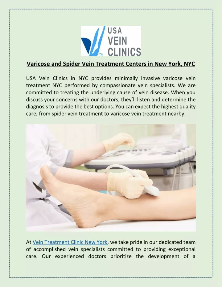 varicose and spider vein treatment centers