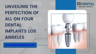 Unveiling the Perfection of All On Four Dental Implants Los Angeles  ID Dental and Implant Center