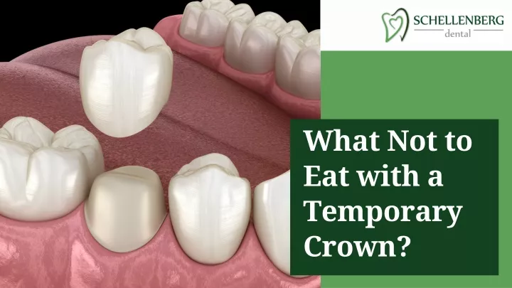 PPT - Temporary Crown Care: Foods to Avoid for Optimal Dental Health ...