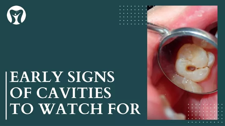early signs of cavities to watch for
