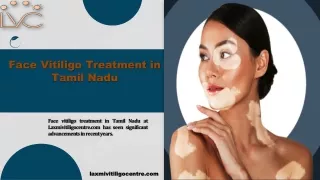 Face Vitiligo Treatment in Tamil Nadu