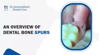 An Overview of Dental Bone Spurs - Dr Amarnathan's Dental Care