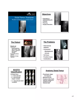 4-Distal-Femur-Lecture