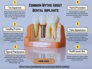 Common Myths About Dental Implants