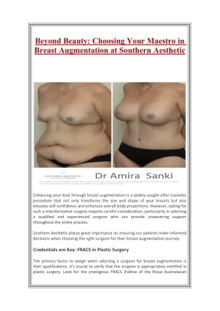 Beyond Beauty: Choosing Your Maestro in Breast Augmentation at Southern Aestheti