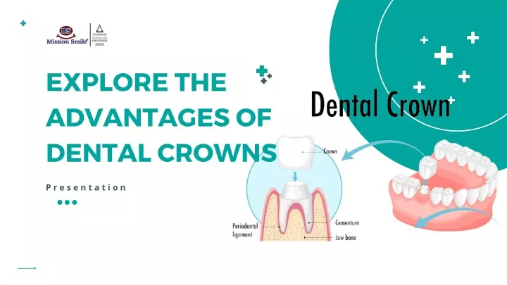 explore the advantages of dental crowns