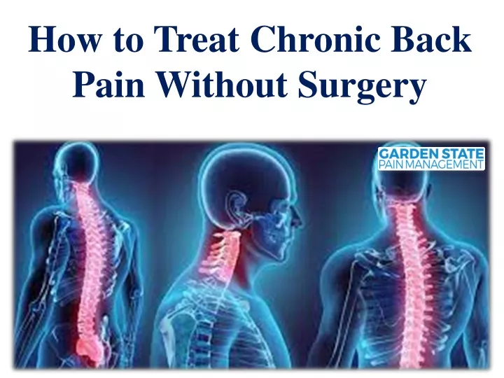 how to treat chronic back pain without surgery