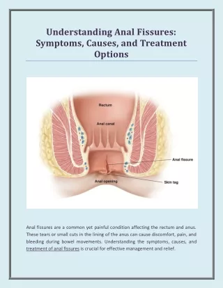 Understanding Anal Fissures - Symptoms, Causes, and Treatment Options