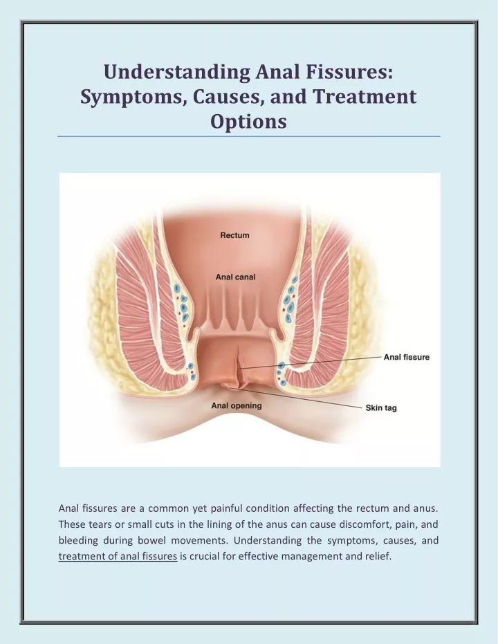 understanding anal fissures symptoms causes