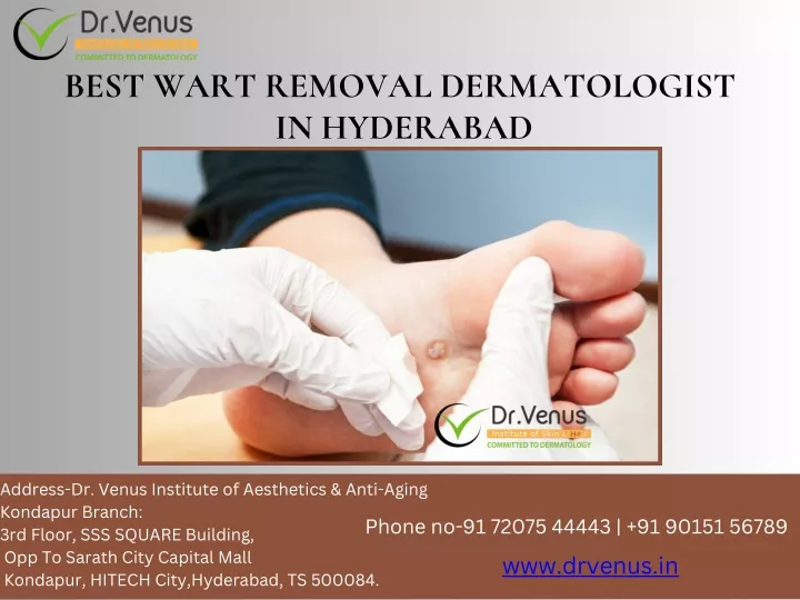 best wart removal dermatologist in hyderabad