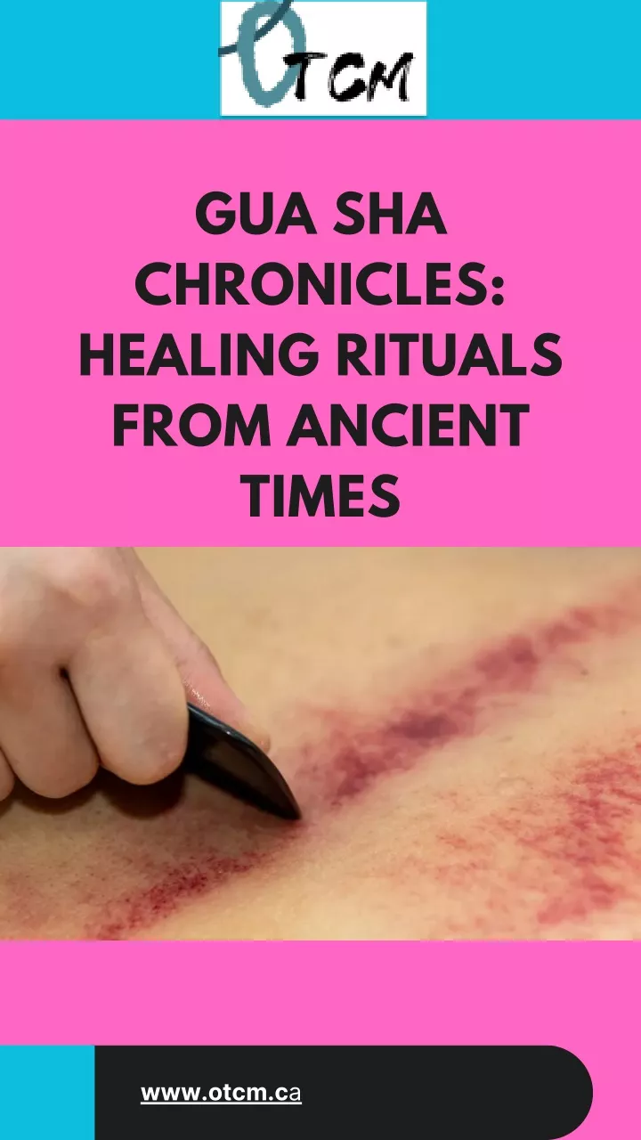 gua sha chronicles healing rituals from ancient