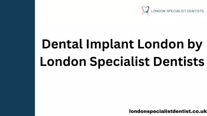 dental implant london by london specialist